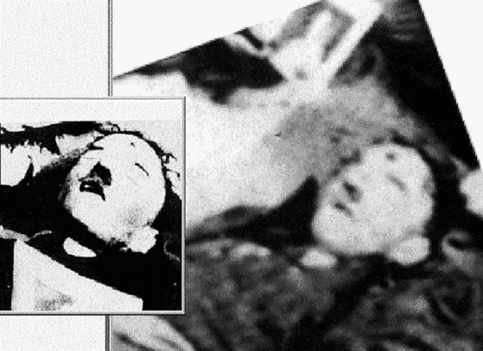 Adolf Hitler's suicide shot to the head