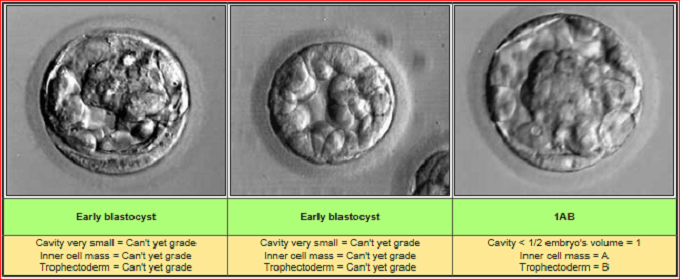 BLASTOCYST 3