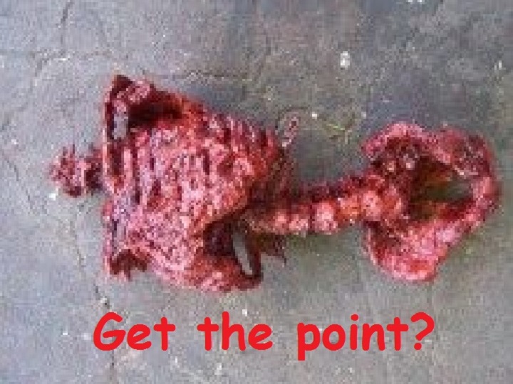 butchered-torso-cadaver-get-the-point