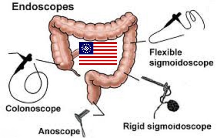 american-nazi-sigmoidoscopy