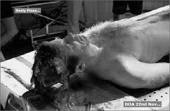 Kennedy ~ Brains ~ The fake 560